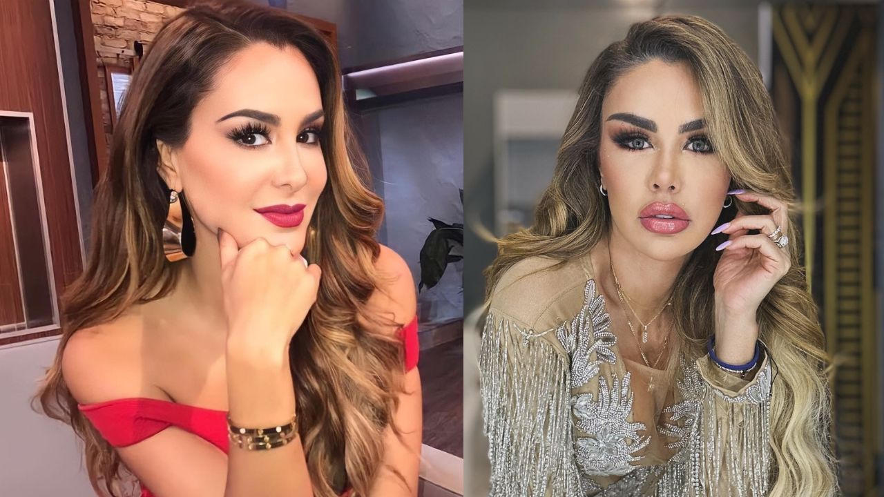 Ninel Conde luce nuevo rostro tras retiro de biopolímeros en Turquía