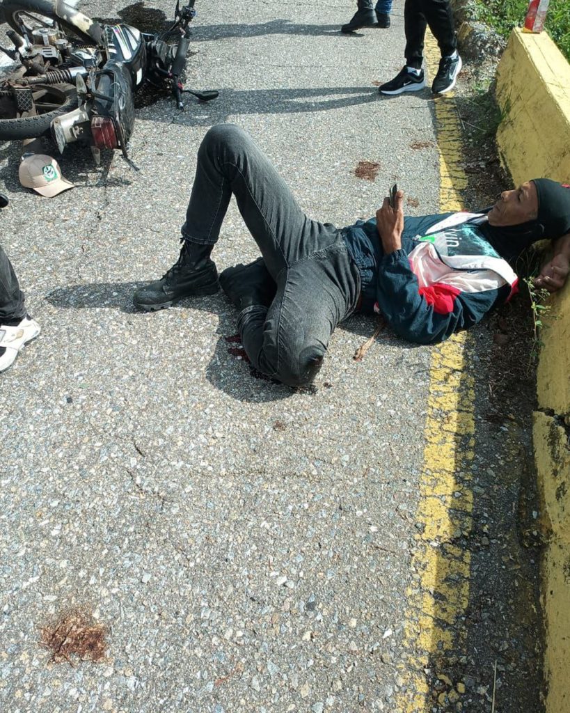 Guardaparques sufrió graves lesiones durante accidente vial elsiglo.com.ve