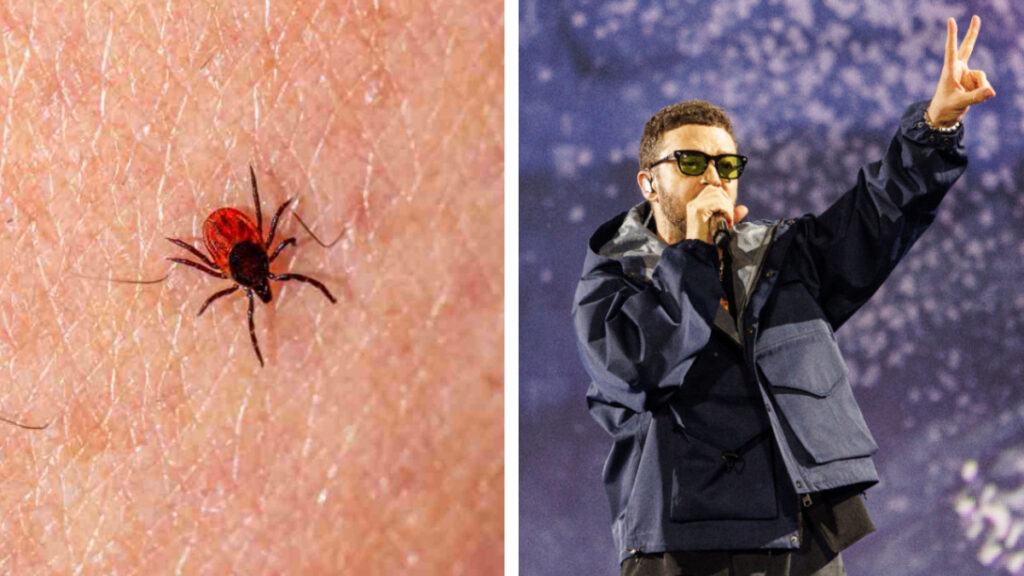 Justin Timberlake revela que padece rara enfermedad