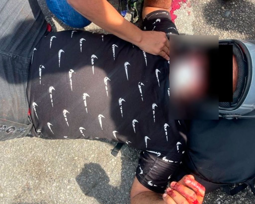 Choque entre motos dejó dos heridos en Maracay elsiglo.com.ve