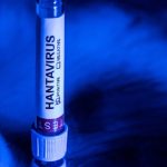 La OMS da por concluido el brote de hantavirus